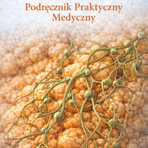 Lipodema — Podręcznik Praktyczny Medyczny